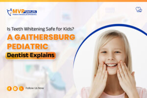 Is Teeth Whitening Safe for Kids A Gaithersburg Pediatric Dentist Explains