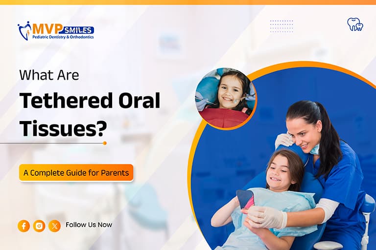 What Are Tethered Oral Tissues